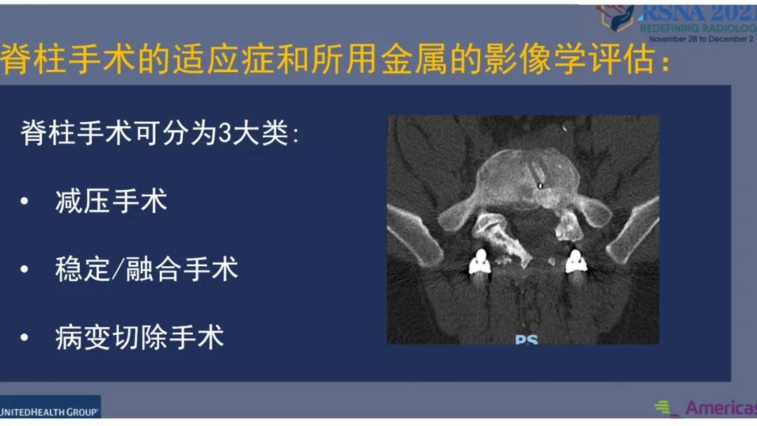 【PPT】术后脊柱-为了外科医生和患者安全着想的金属图像-5