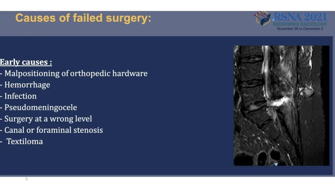 【PPT】术后脊柱-为了外科医生和患者安全着想的金属图像-28