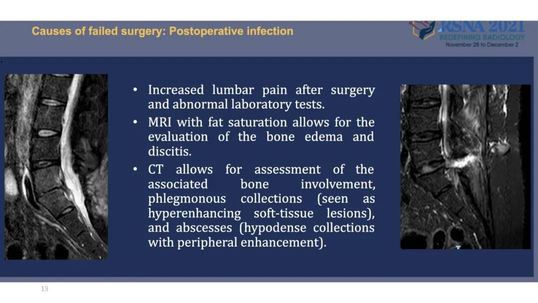 【PPT】术后脊柱-为了外科医生和患者安全着想的金属图像-36