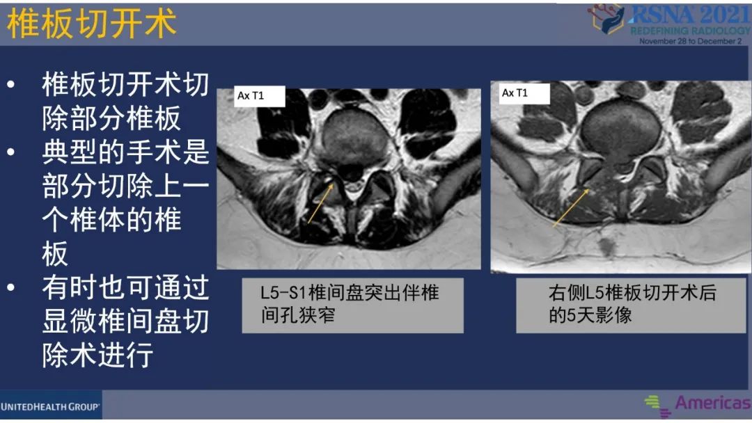 【PPT】术后脊柱-为了外科医生和患者安全着想的金属图像-9