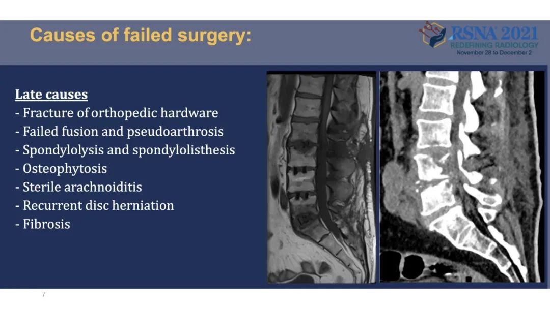【PPT】术后脊柱-为了外科医生和患者安全着想的金属图像-30