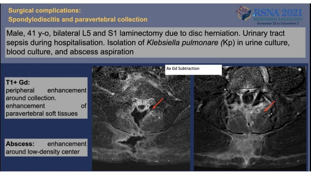【PPT】术后脊柱-为了外科医生和患者安全着想的金属图像-40