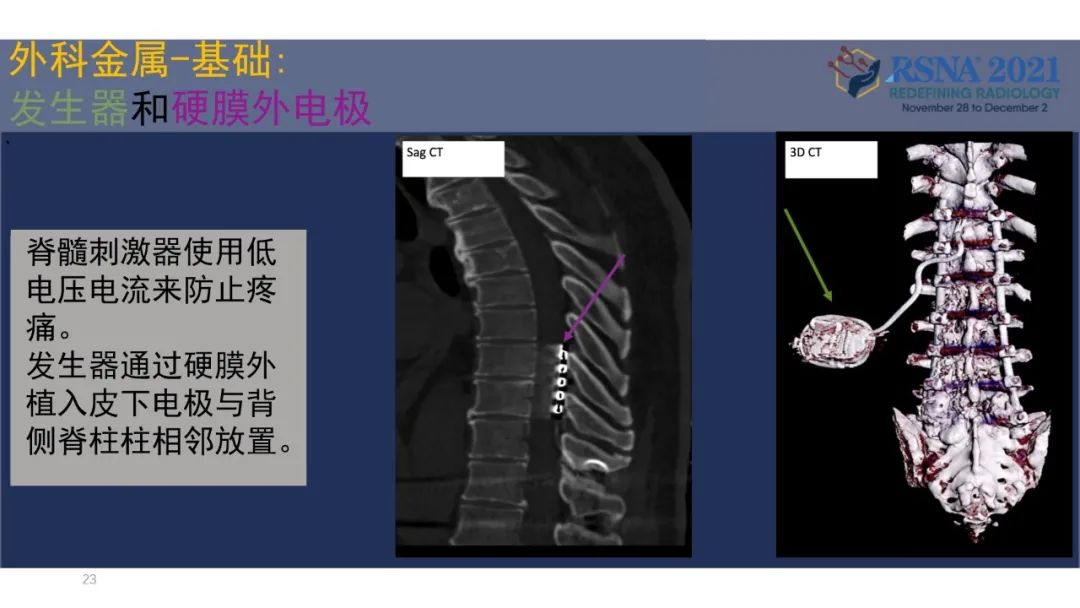 【PPT】术后脊柱-为了外科医生和患者安全着想的金属图像-23