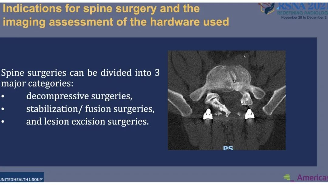【PPT】术后脊柱-为了外科医生和患者安全着想的金属图像-6