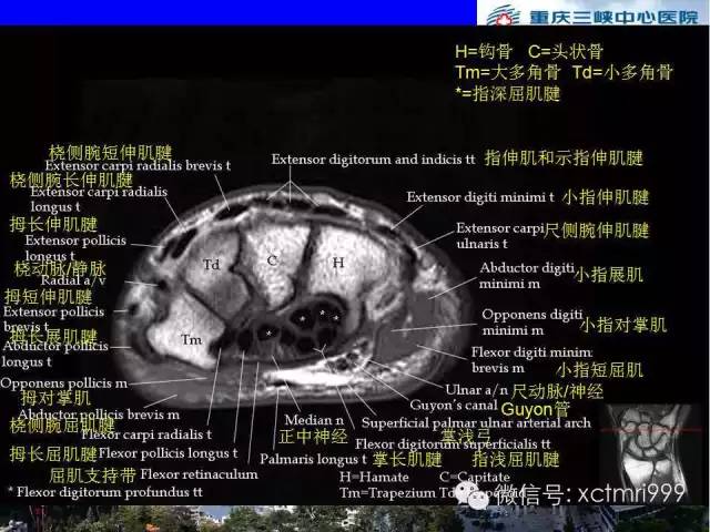 【PPT】腕关节MRI解剖中英对照-44