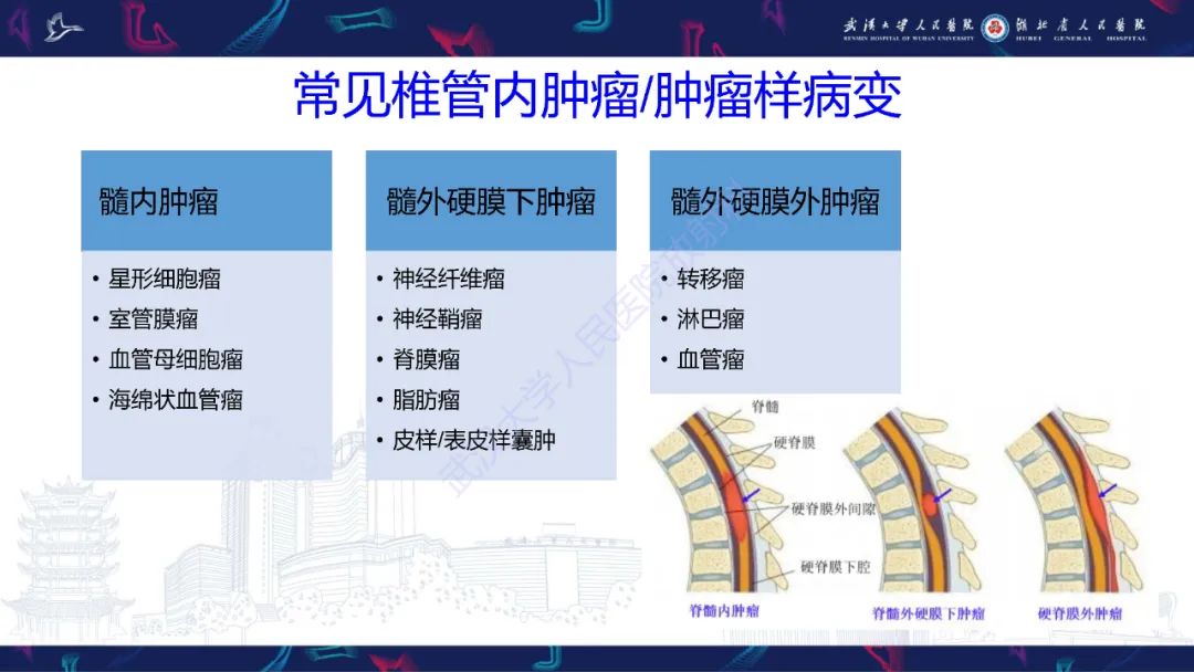 【PPT】椎管内孤立性纤维瘤/血管外皮细胞瘤影像诊断-5