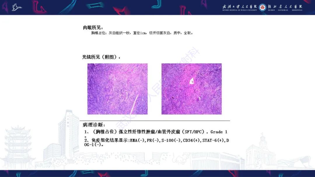 【PPT】椎管内孤立性纤维瘤/血管外皮细胞瘤影像诊断-7