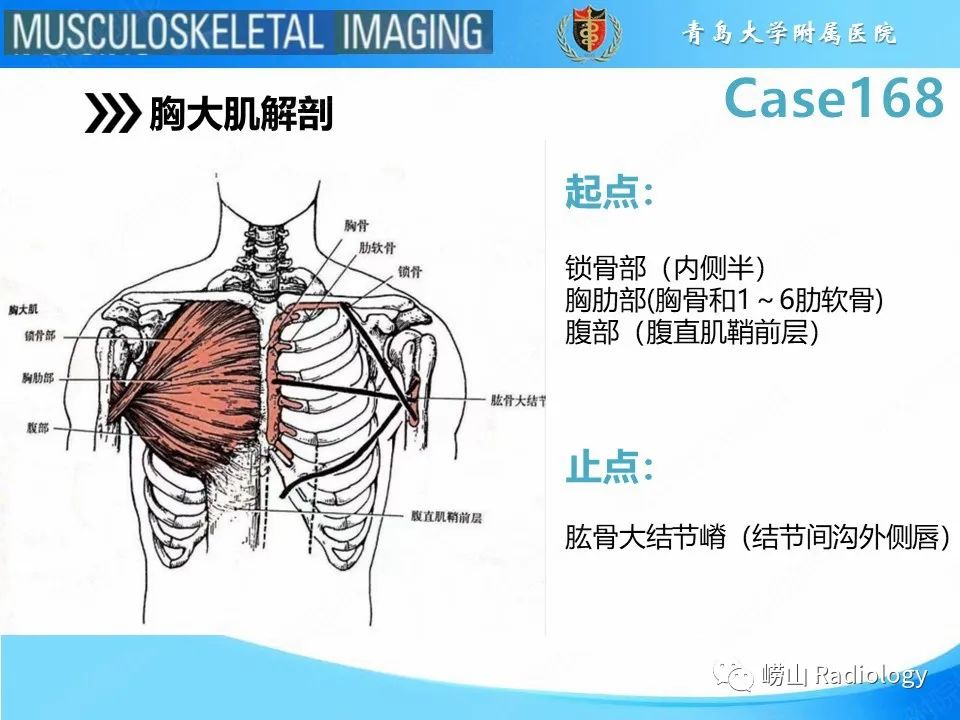【PPT】胸大肌撕裂-12
