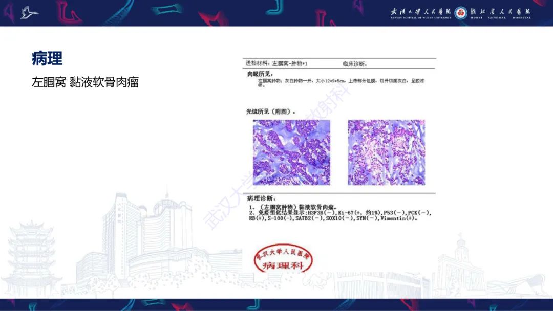 【PPT】骨外粘液样软骨肉瘤影像诊断-4