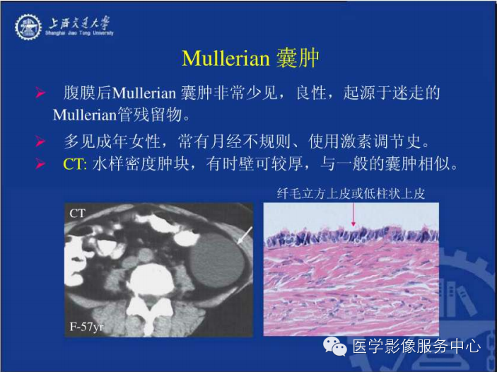 腹膜后间隙病变的影像诊断