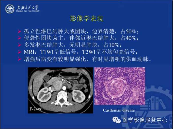 腹膜后间隙病变的影像诊断