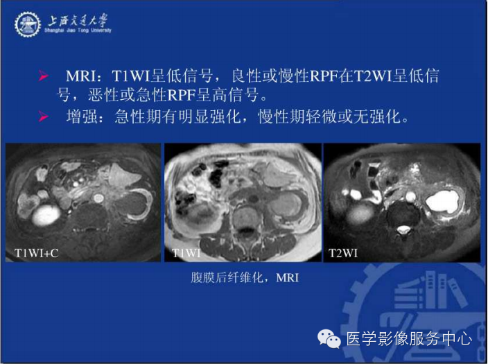 腹膜后间隙病变的影像诊断