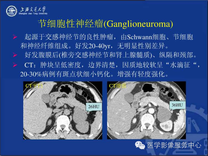 腹膜后间隙病变的影像诊断