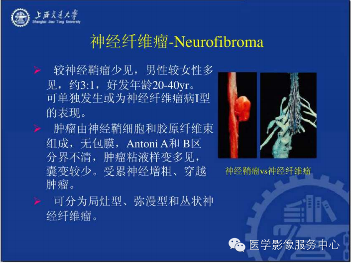 腹膜后间隙病变的影像诊断