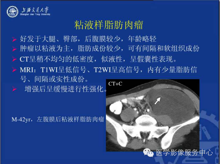 腹膜后间隙病变的影像诊断