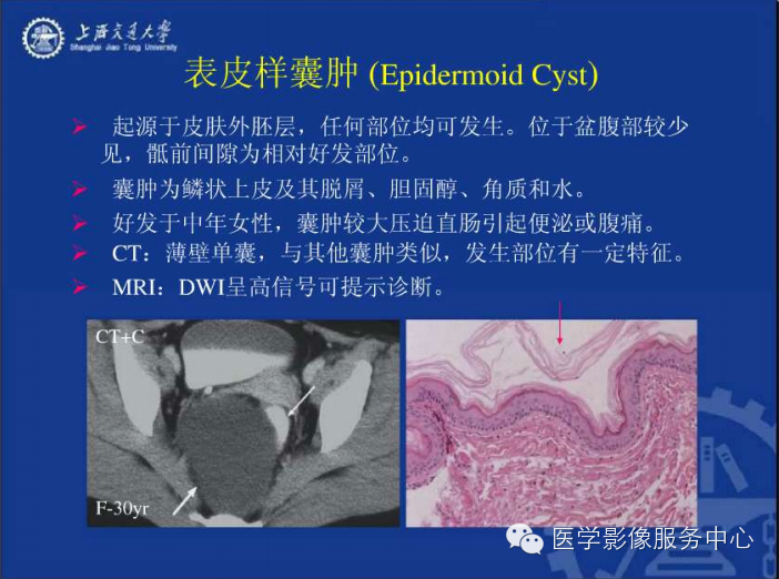 腹膜后间隙病变的影像诊断