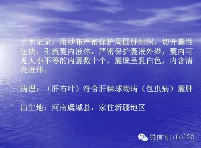 【典型病例】肝脏、脾脏、腹腔包虫病一例