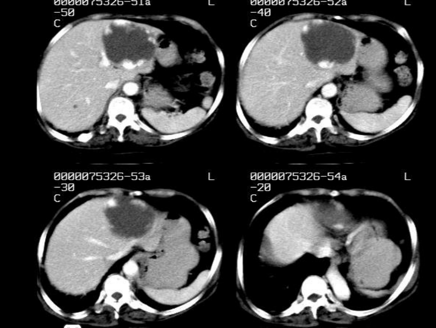 肝胆胰脾影像诊断学