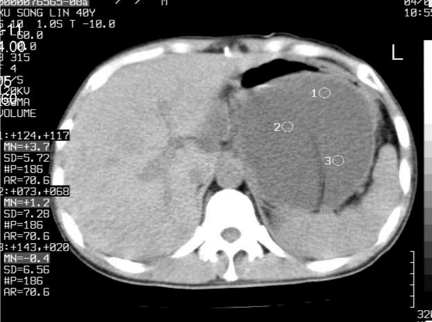 肝胆胰脾影像诊断学