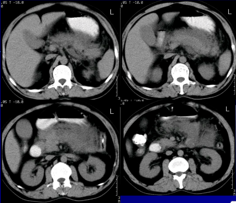 肝胆胰脾影像诊断学