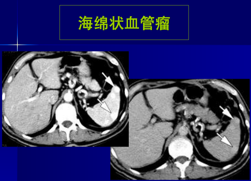 肝胆胰脾影像诊断学