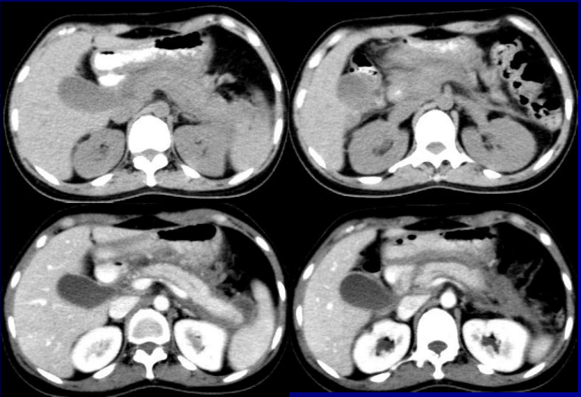 肝胆胰脾影像诊断学