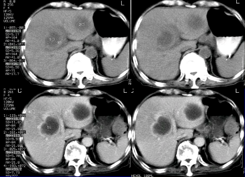 肝胆胰脾影像诊断学