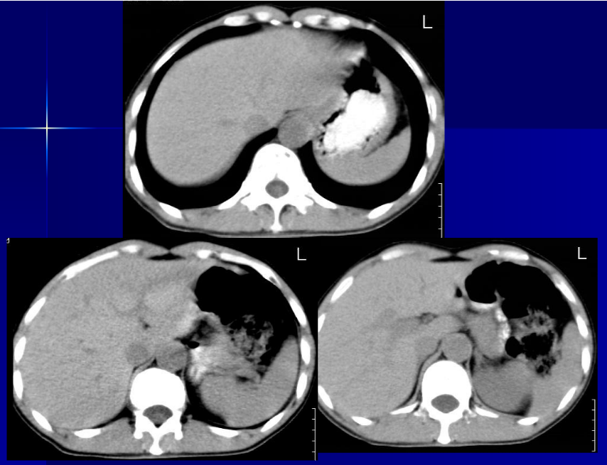 肝胆胰脾影像诊断学