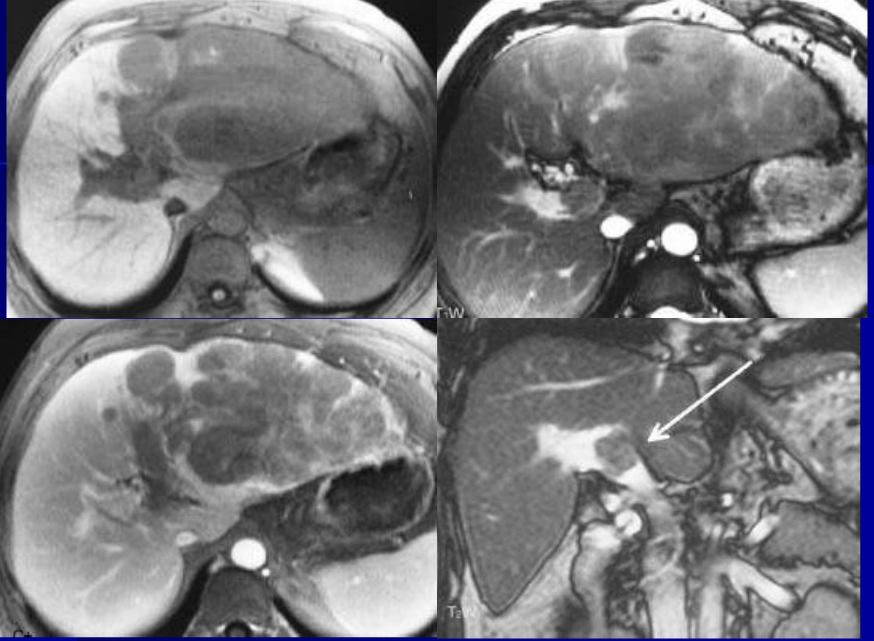 肝胆胰脾影像诊断学