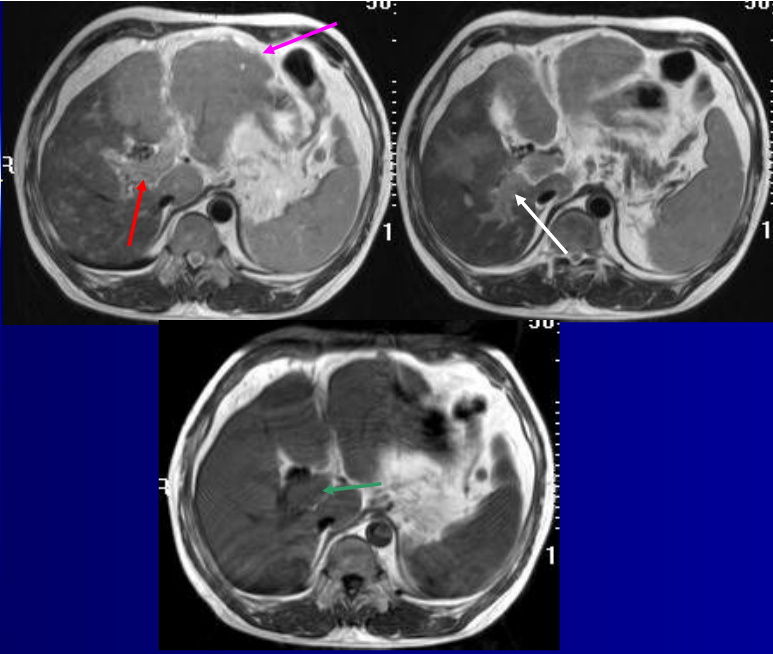 肝胆胰脾影像诊断学