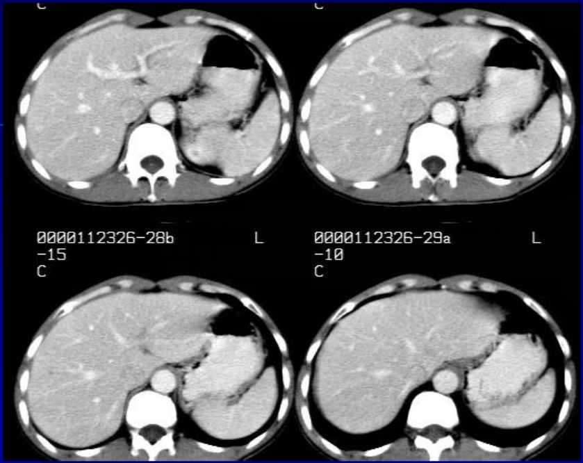 肝胆胰脾影像诊断学