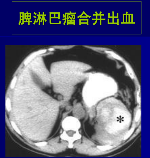 肝胆胰脾影像诊断学