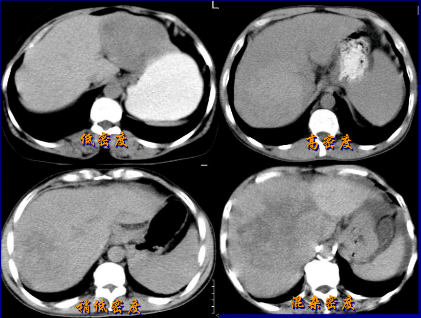 肝胆胰脾影像诊断学