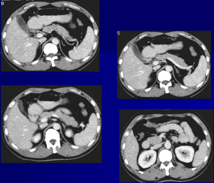 肝胆胰脾影像诊断学