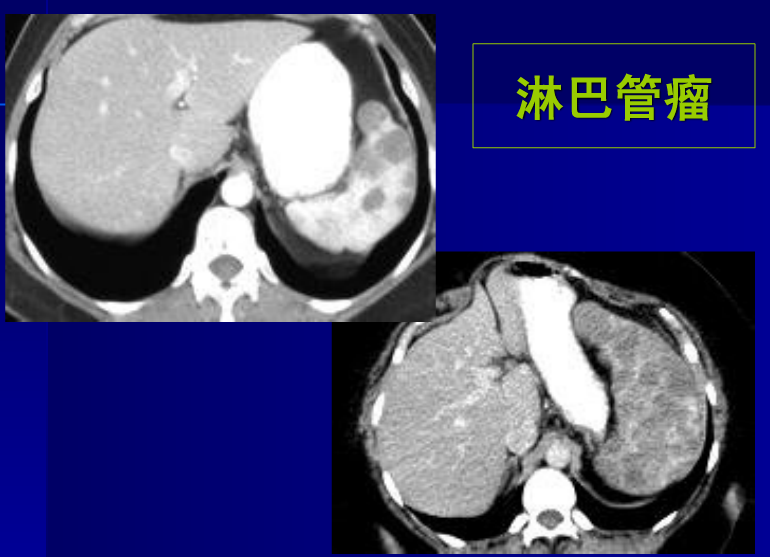 肝胆胰脾影像诊断学