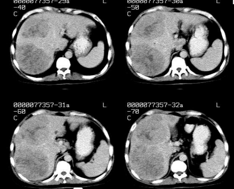 肝胆胰脾影像诊断学