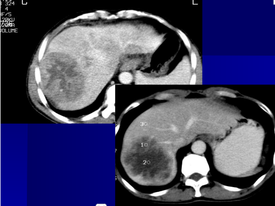 肝胆胰脾影像诊断学