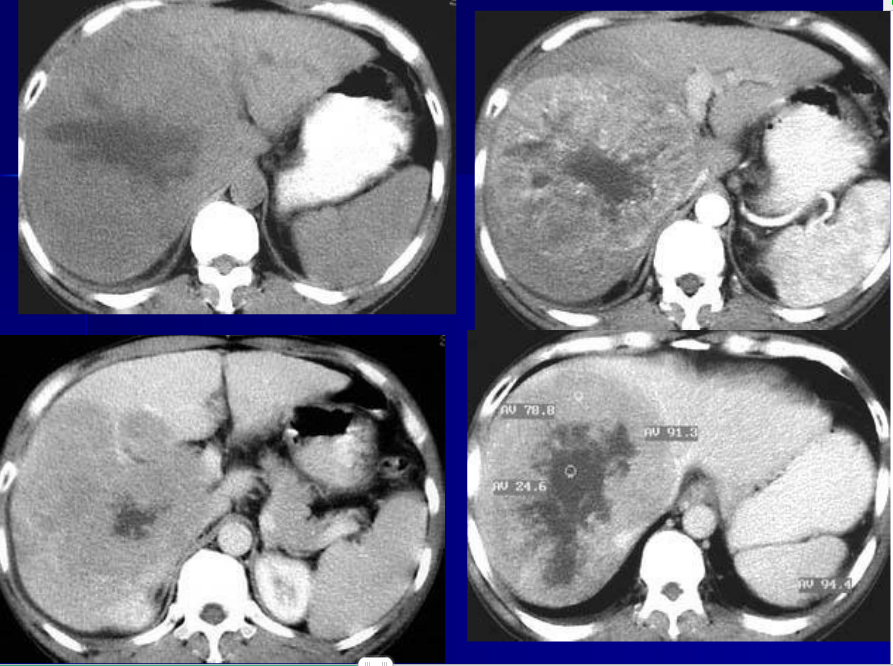 肝胆胰脾影像诊断学