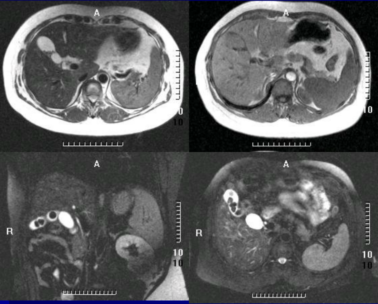 肝胆胰脾影像诊断学
