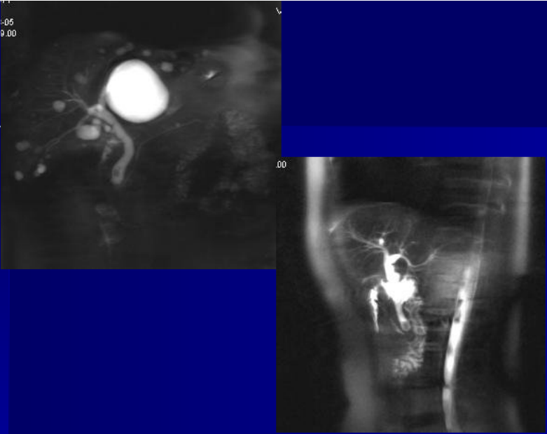 肝胆胰脾影像诊断学