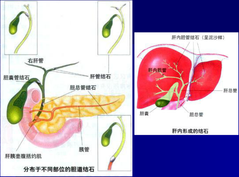 肝胆胰脾影像诊断学