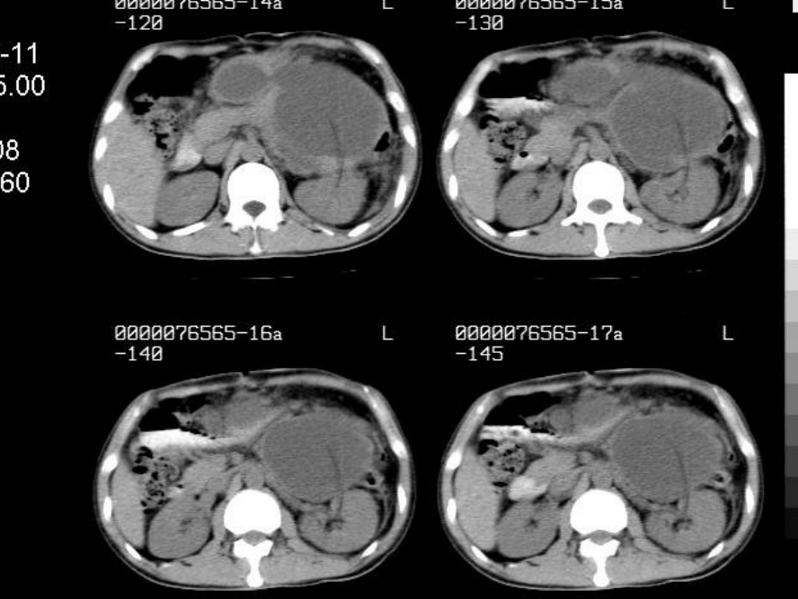 肝胆胰脾影像诊断学