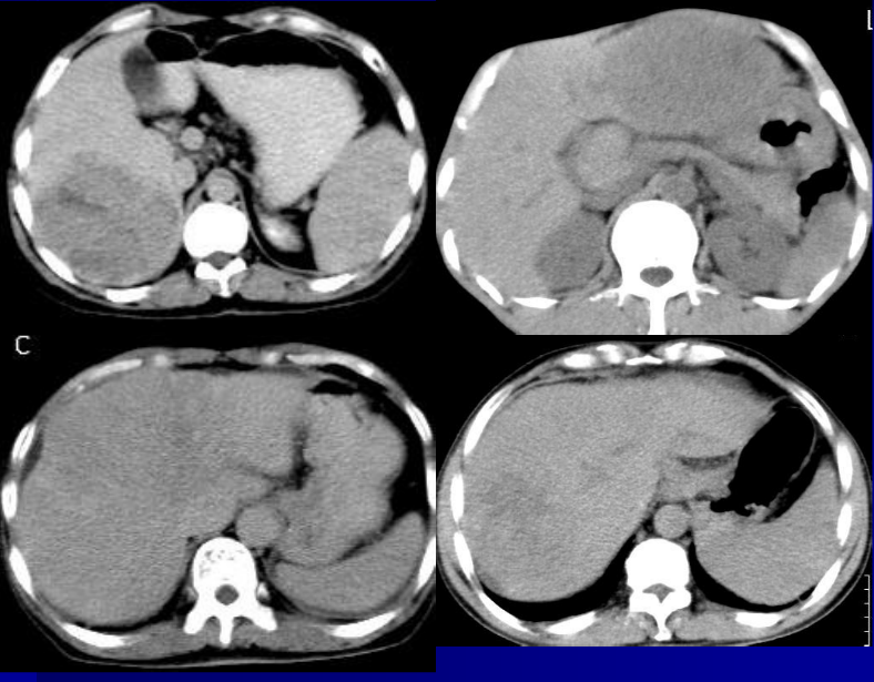 肝胆胰脾影像诊断学