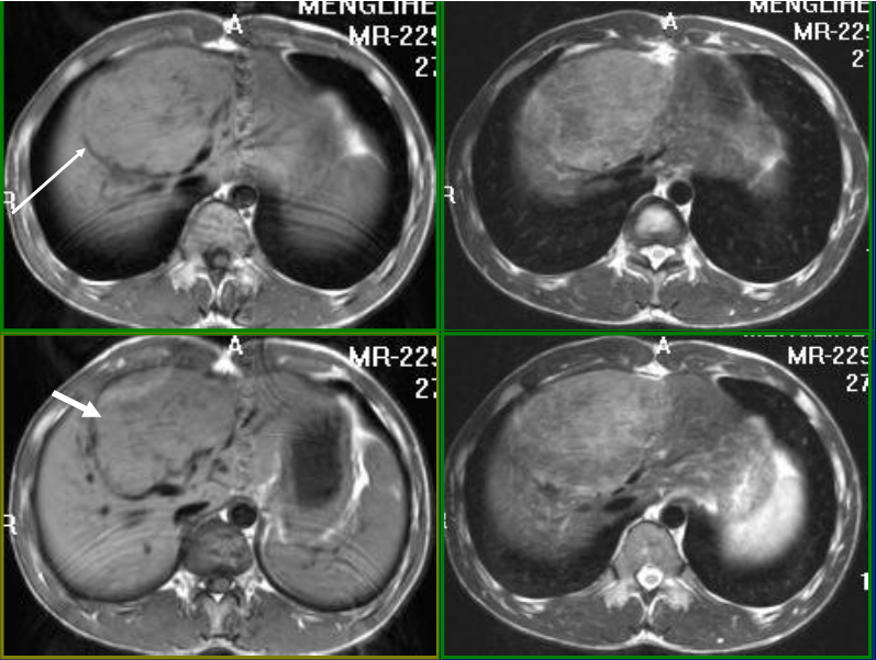 肝胆胰脾影像诊断学