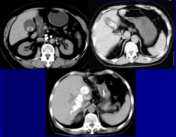肝胆胰脾影像诊断学