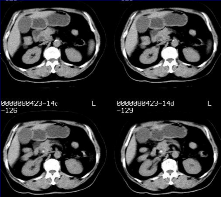 肝胆胰脾影像诊断学
