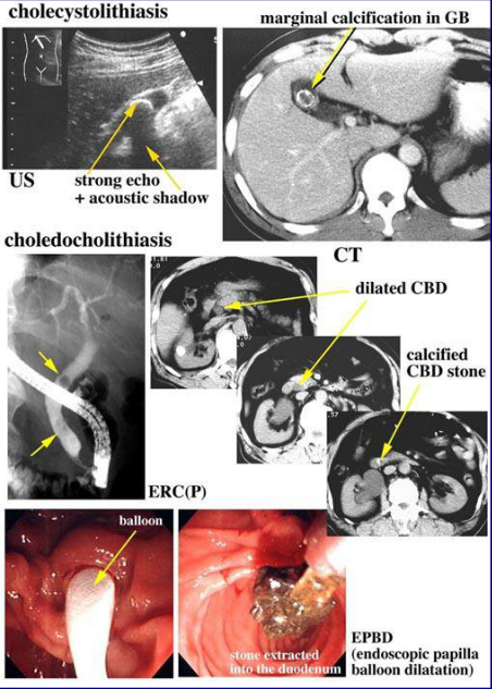 肝胆胰脾影像诊断学