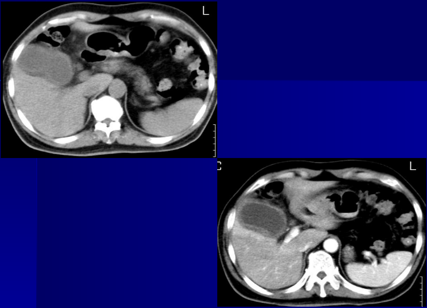 肝胆胰脾影像诊断学