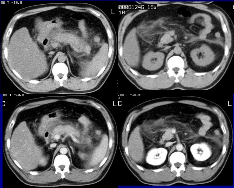 肝胆胰脾影像诊断学