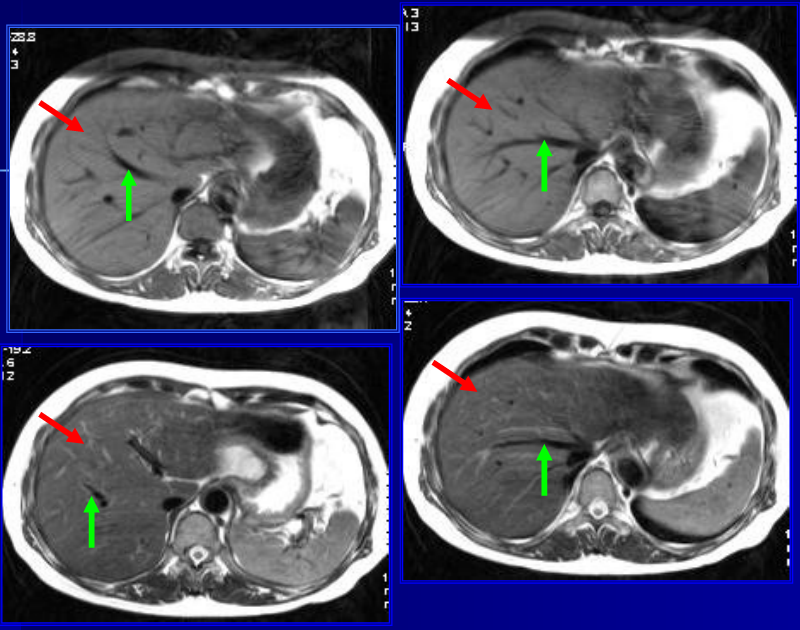 肝胆胰脾影像诊断学